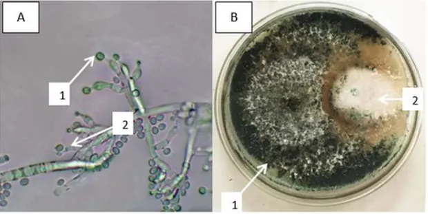 Gambar 1.  Pengamatan  Trichoderma  sp.  secara  makroskopis  dan  mikroskopis  (A)  Pengamatan  Secara  Mikroskopis  Trichoderma  sp.,  1)