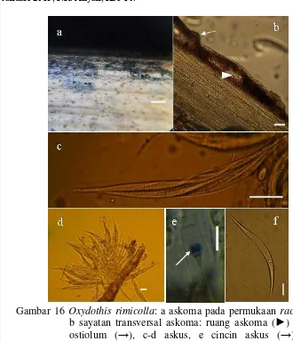 Gambar 16 Oxydothis rimicolla: a askoma pada permukaan rachis, b sayatan transversal askoma: ruang askoma (►) dan ostiolum (→), c-d askus, e cincin askus (→), f askospora