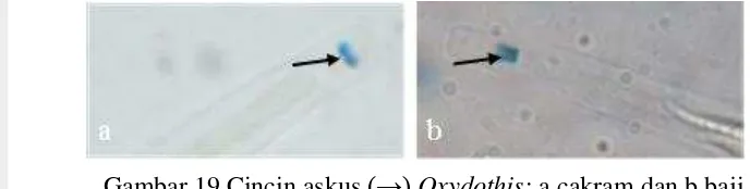 Gambar 19 Cincin askus (→) Oxydothis: a cakram dan b baji 