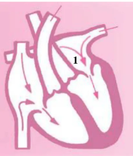 Gambar di atas menunjukkan serambi jantung yang mengembang. Apa yang terjadi pada  bagian jantung nomor 1? 