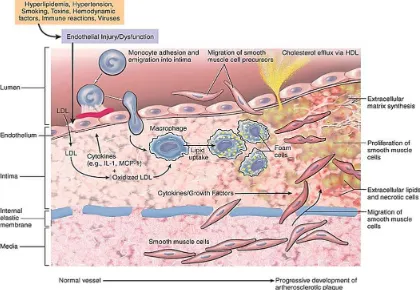 Gambar 5 : proses terbentuknya aterosklerosis 12