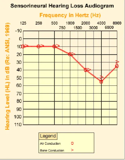 Gambar 2.4 Audiogram (American Speech Language Hearing Association,  2013)  