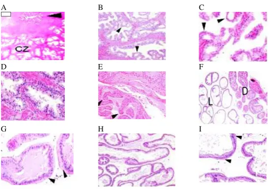 Figure 1. Comparison of human and mouse prostate anatomy. A, adult human prostate is divided (VP), dorsal and lateral lobes, which are grouped together as DLP central zone (CZ)