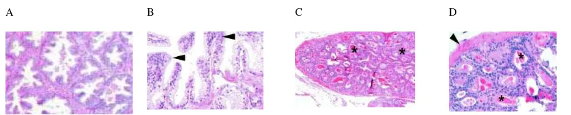 Figure 3. Comparison of human and mouse hyperplasia. A and B, human benign prostate hyperplasia, showing the increase of gland numbers