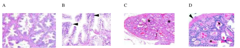 Figure 3. Comparison of human and mouse hyperplasia. A and B, human benign prostate hyperplasia, showing the increase of gland numbers