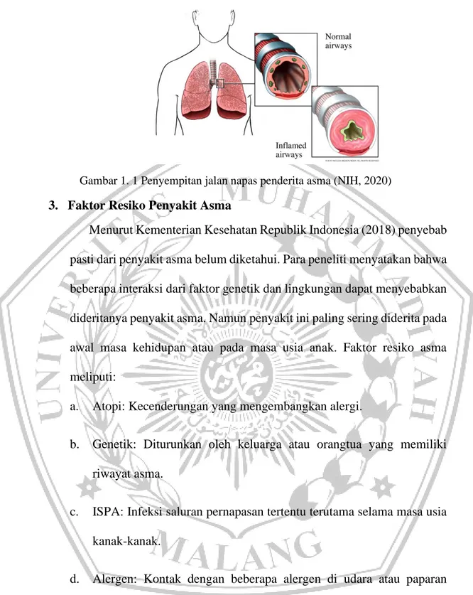 Gambar 1. 1 Penyempitan jalan napas penderita asma (NIH, 2020) 3.  Faktor Resiko Penyakit Asma 
