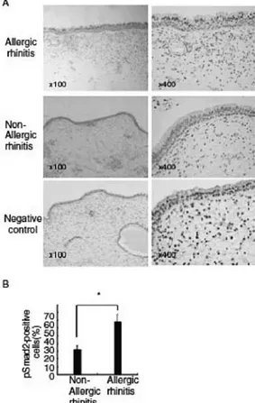 Gambar 6: Fosforilasi Smad2 dideteksi dominan pada sel epitel mukosa nasal pasien dengan RA