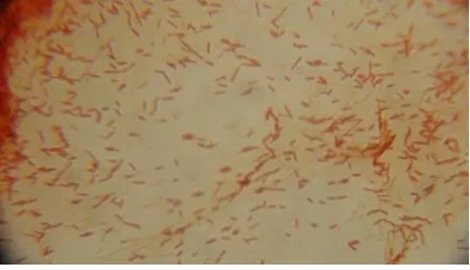 Gambar 10. Bacillus – Gram Positif  