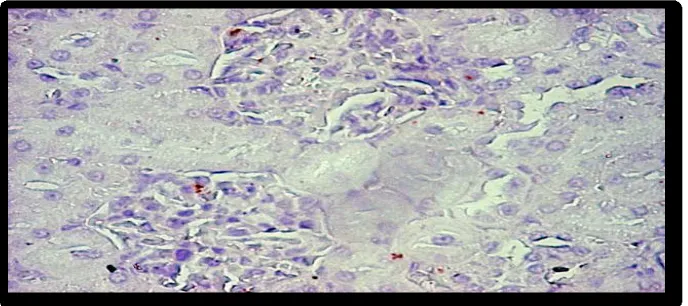 Gambar 10 : Ekspresi VEGF podosit  glomerulus ginjal tikus SD (K-2)  dengan proportion score (PS) :0 dan intensity score (IS) : 0 , pada pembesaran gambar 200x