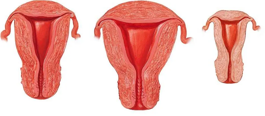 Gambar 3. Perbedaan ukuran uterus pada wanita dewasa nulipara (kiri), multipara (tengah) dan 