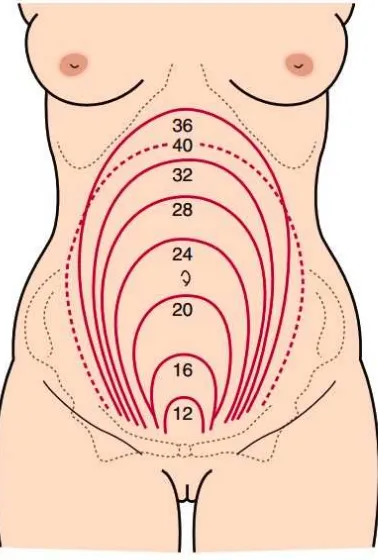 Gambar 4. Tinggi fundus dari kehamilan 