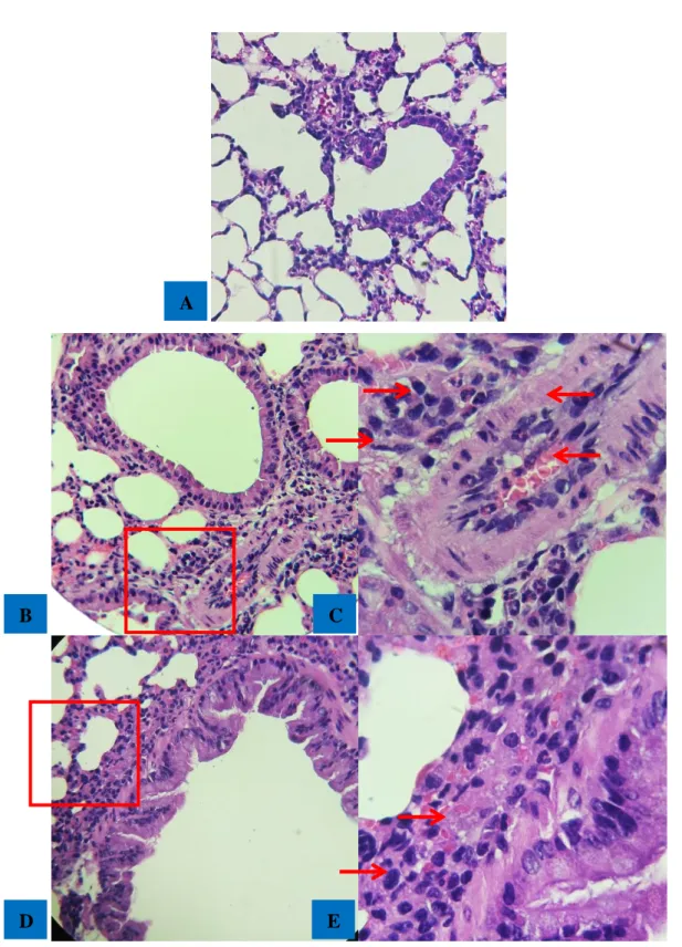 Gambar 2. (A) Tidak terdapat infiltrasi eosinofil pada kelompok kontrol negatif (perbesaran 