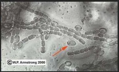 Gambar 6 . Filamentous cyanobacteria (Anabaena azollae) dari rongga dalam             