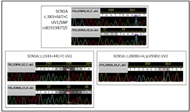 Figure 7. Results of SCN1A primers with three controls and 26 exons tested. 