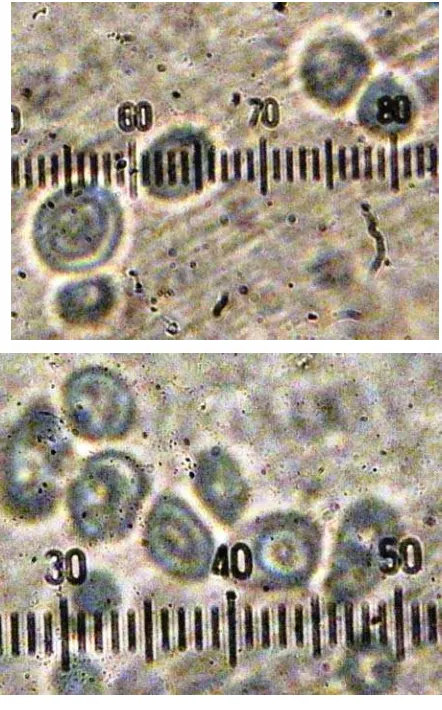 Gambar 4.3 Morfologi sel Saccharomyces sp. strain liar (a), dan morofologi sel setelah perlakuan sinar radiasi ultraviolet dengan intensitas 20 Watt dengan waktu 30 detik (a), 40 detik (b), 50 detik (c), 60 detik (d) dengan perbesaran 1000x
