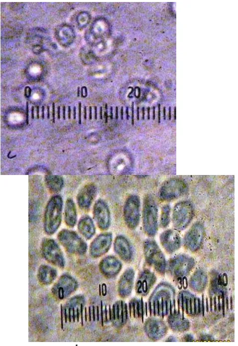 Gambar 4.5 Morfologi sel Saccharomyces sp. strain liar (a), dan morfologi sel setelah  perlakuan sinar radiasi ultraviolet dengan intensitas 30 Watt dengan waktu 30 detik (a), 40 detik (b), 50 detik (c), 60 detik (d) dengan perbesaran 1000x