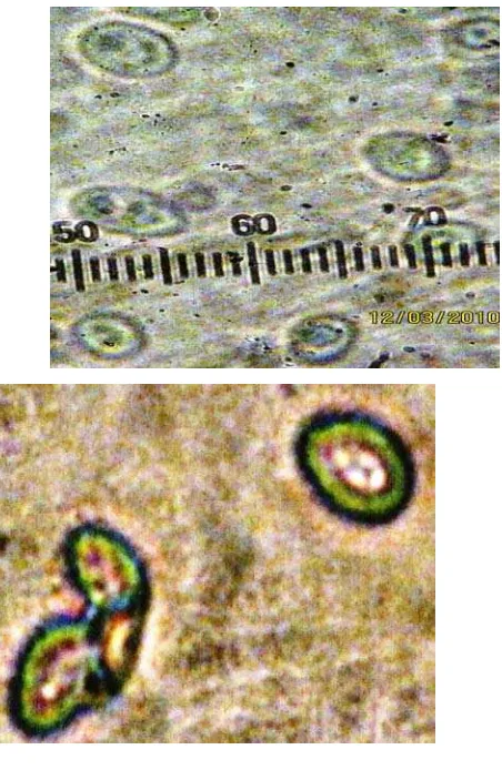 Gambar 4.7 Morfologi sel Saccharomyces sp.  strain liar (a), dan morfologi sel setelah  perlakuan sinar radiasi ultraviolet dengan intensitas 30 Watt dengan waktu 30 detik (a), 40 detik (b), 50 detik (c) dengan perbesaran 1000x