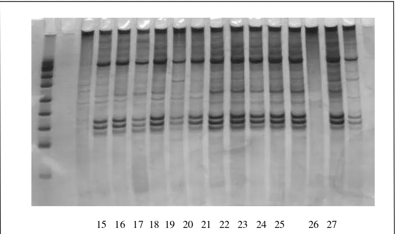 Gambar 2. ALAD genotyping sampel darah anak 9-14