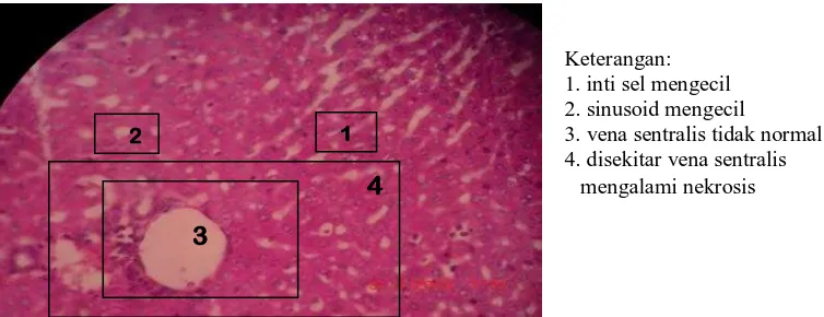 Gambar 10. Histopatologi hepar marmut perlakuan 5 dengan dosis 1240 mg/kg bb           perbesaran 10 X 40     