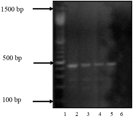 Figure 2: Optimation of PCR Essay  Using Positive Control    Figure 2. Results of PCR analysis on positive and negative control   