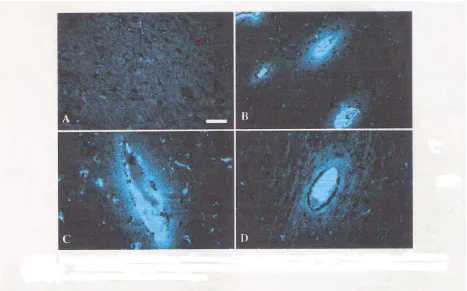 Gambar. 1 Fotomikrografi memperlihatkan polesan imunofluorescensi potongan jaringan otak manusia yang dilakukan eksisi pembedahan