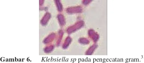 Gambar 6. Klebsiella Klebsiella sp pada pengecatan gram.31  sp tumbuh optimal pada suhu 35-37oC dan pH 7,2