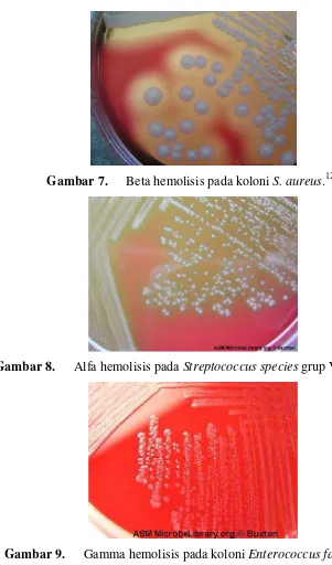 Gambar 9. Gamma hemolisis pada koloni Enterococcus faecalis.123