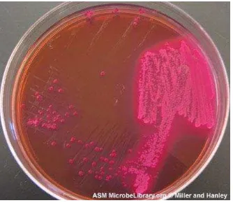 Gambar 11. Koloni E. coli pada MAC memfermentasi laktosa.127