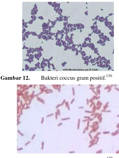 Gambar 13. Bakteri batang gram negatif.130
