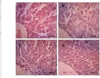 Gambar 4  Gambaran histologis hati terlihat perubahan susunan hepatosit dan 
