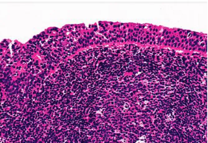 Gambar  2.2.  Histologi  nasofaring.  Epitel  pelapis  nasofaring  terdiri  dari  epitel  transisional  dengan  stroma yang kaya jaringan limfoid (dikutip dari Mills SE