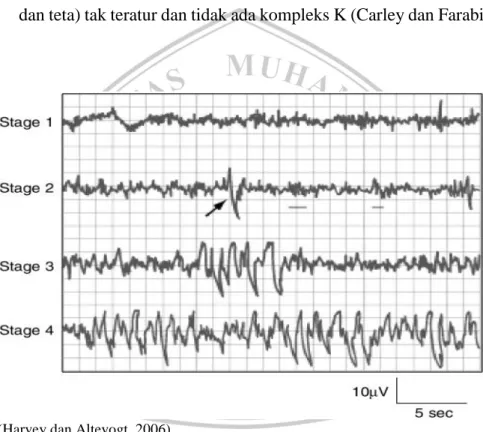 Gambar 2.1 Gambaran EEG Fase Tidur 