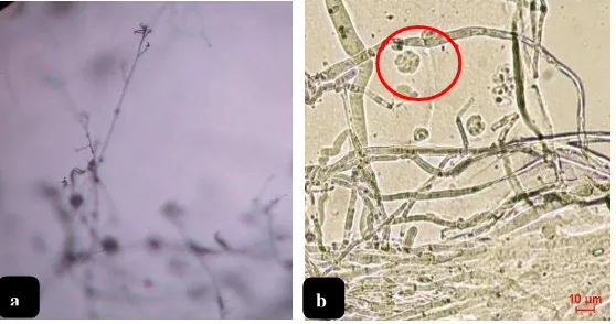 Gambar 3  Cendawan hasil isolasi larva penggerek batang (a)  