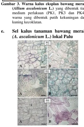 Gambar  6.    Rata-rata  lebar  sel  kalus  bawang  merah  (A.  ascalonicum  L.)  pada  masing-  masing  perlakuan  yang  di  cobakan