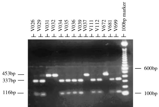Figure 3. Gel photographs of an ethidium bromide stained agarose gel showing mitochondrial ND-5 polymorphism detected by PCR-RFLP using HindIII