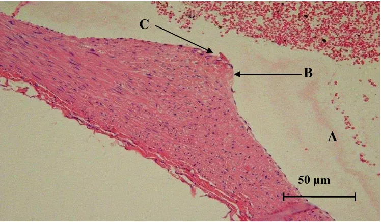 Gambar 3. Gambaran histopatologis aorta tikus putih yang diberi pakan lemak tinggi (K1) selama 90 hari