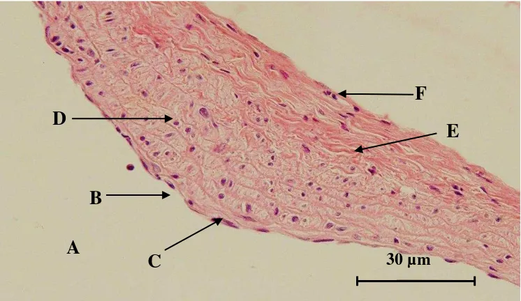 Gambar 5. Gambaran histopatologis aorta tikus putih yang diberi pakan lemak tinggi selama 90 hari, 