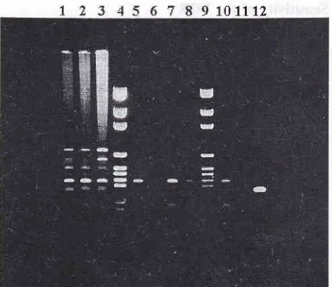 Figure 4, Electrophoretogram ofprimary PCR products using