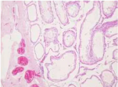 Gambar histopatologis testis tikus kelompok kontrol dengan perbesaran 1000x.  (1) Sel Sertoli