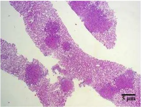 Figure 1. Liver biopsy, acid fast bacilli staining, 100x