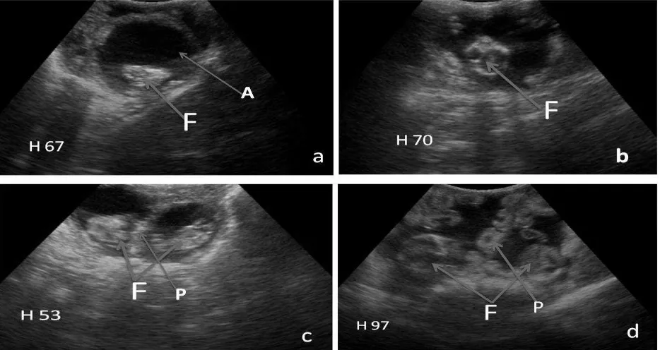 Gambar 1 . Gambaran hasil estimasi fetus pada layar monitor ultrasound (F= Fetus, P= Plasenta, A= Amnion, H= Hari kebuntingan) 