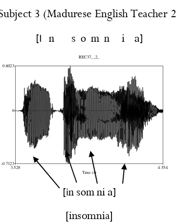 Figure 8. The Comparation of Oscillographic Pronunciation of ‘insomnia’  