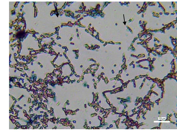 Gambar 18  Pewarnaan spora isolat S3 (Bacillus subtilis) 