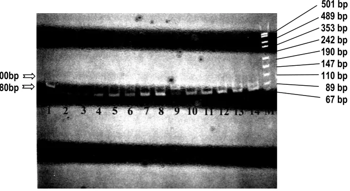 Figure 3. Electrophoresis of Polymerase Chain Reaction (PCR) result of ALDH2 gene. M: DNA Molecular Weight Marker (pUC/Msp I); Lanes 1-6, 8-11: PCR product (100 bp) from different DNA samples; Lane 7: Negative Control (no DNA sample)