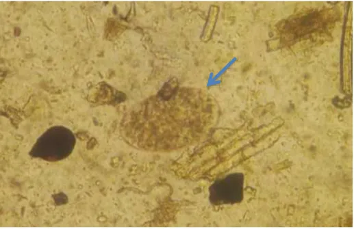 Gambar 1. Telur cacing Fasciola sp (tanda panah) dengan perbesaran 100 x menggunakan                         mikroskop 
