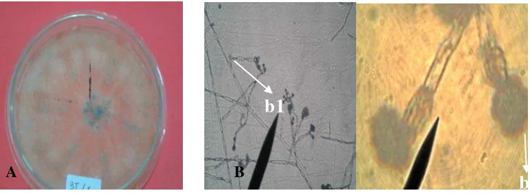 Gambar 4. Penicillium simplicissimum. (A) Bentuk koloni; (B) Bentuk Mikroskopis; (b1) Hifa, (b2) Konidia