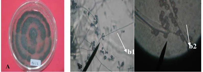Gambar 6.  Arthrinium phaespermum. (a) Bentuk koloni; (B) Bentuk Mikroskopis; (b1) Hifa, (b2) Konidia