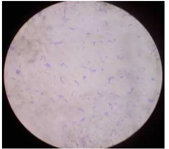 Gambar 4.  Morfologi L. plantarum 1B1 