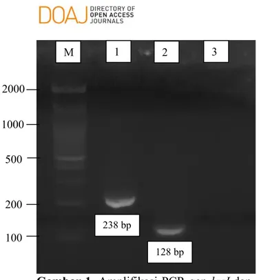Tabel 3. Hasil PCR P. aeruginosa yang Terisolasi dari Spesimen Klinis di Instalasi  Mikrobiologi RSUP Sanglah Tahun 2013-2016 