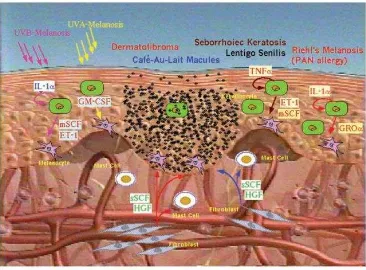 Gambar 2.10.    Dikutip  dari kepustakaan no 28. Model sitokin parakrin  hiperpigmentasi epidermal pada melanosis-UVB, melanosis UVA, lentigo senilis, keratosis seboroik, melanosis Rielh, dermatofibroma, dan makula café-au-lait